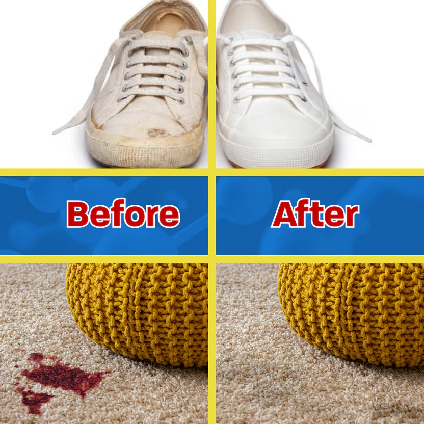 Stingray Instant Spot Remover - Image 3